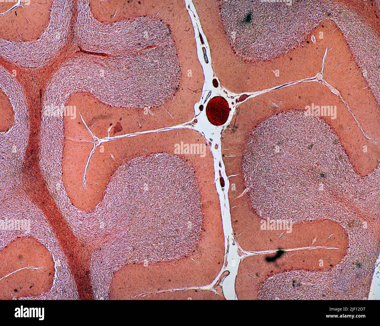 Abschnitt des kleinen Gehirns (Cerebellum) mit Purkinje-Zellen. Stockfoto