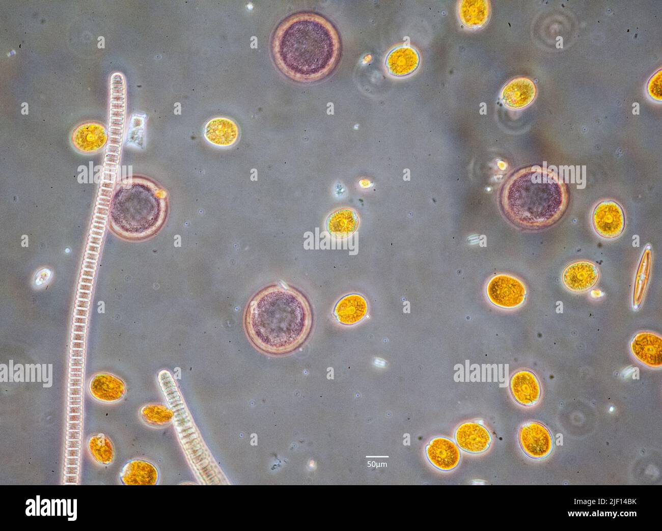 Flagellaten der Geenera Amphidinium (gelb) und Diplopsalis (rot) zusammen mit einer einzigen Kieselalgenzelle und einer Cyanobakterienkette. Probenentnahme Stockfoto