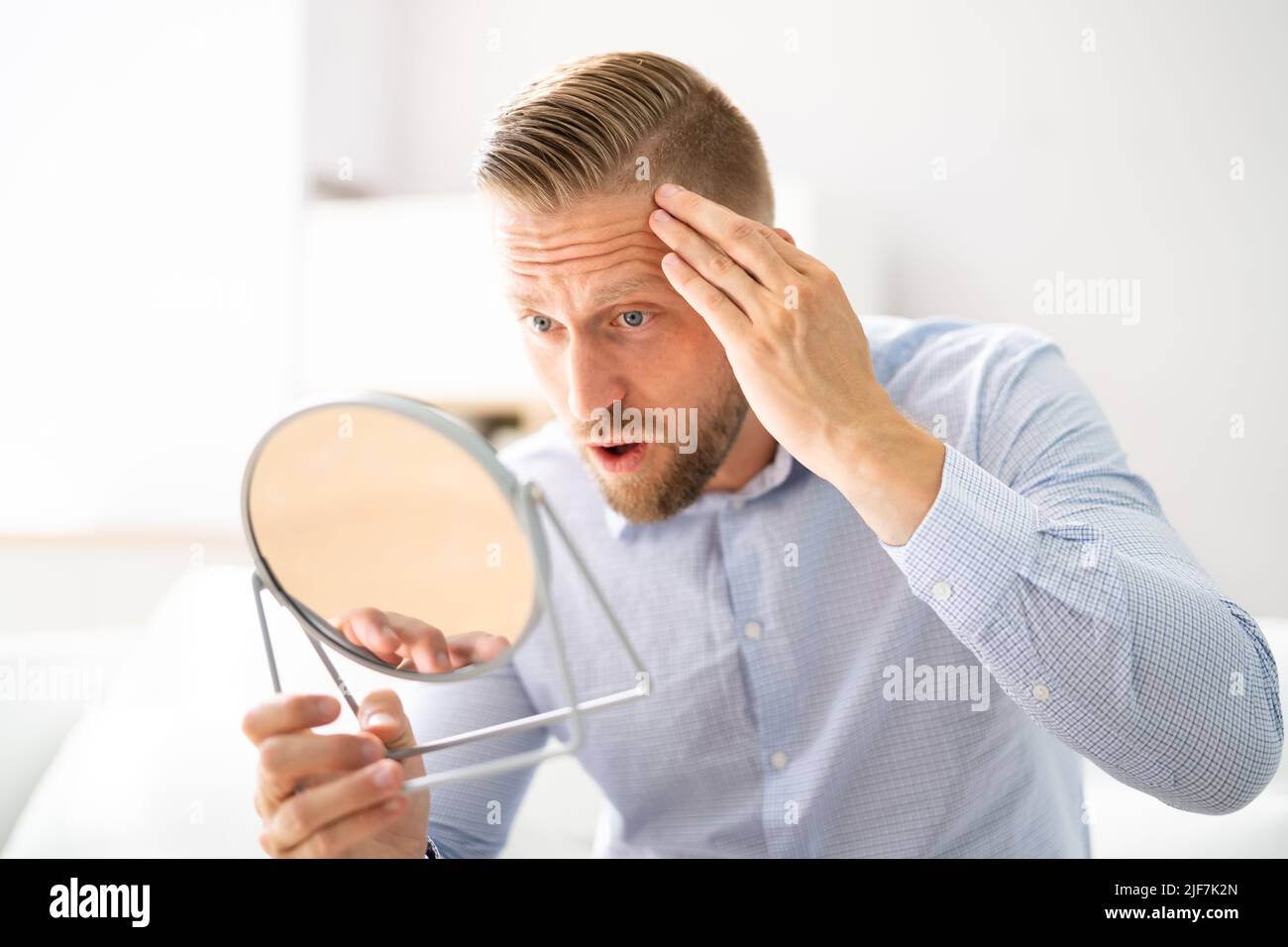 Alopecia Man Haarausfall. Verzweiflung Und Emotionaler Stress Stockfoto