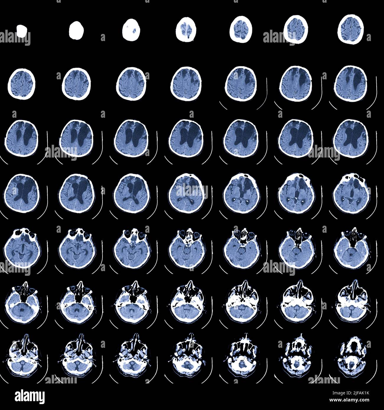 MRT-Untersuchung des Gehirns. Magnetresonanztomographie. Medizin, Wissenschaft und Bildung CT-Hintergrund Stockfoto