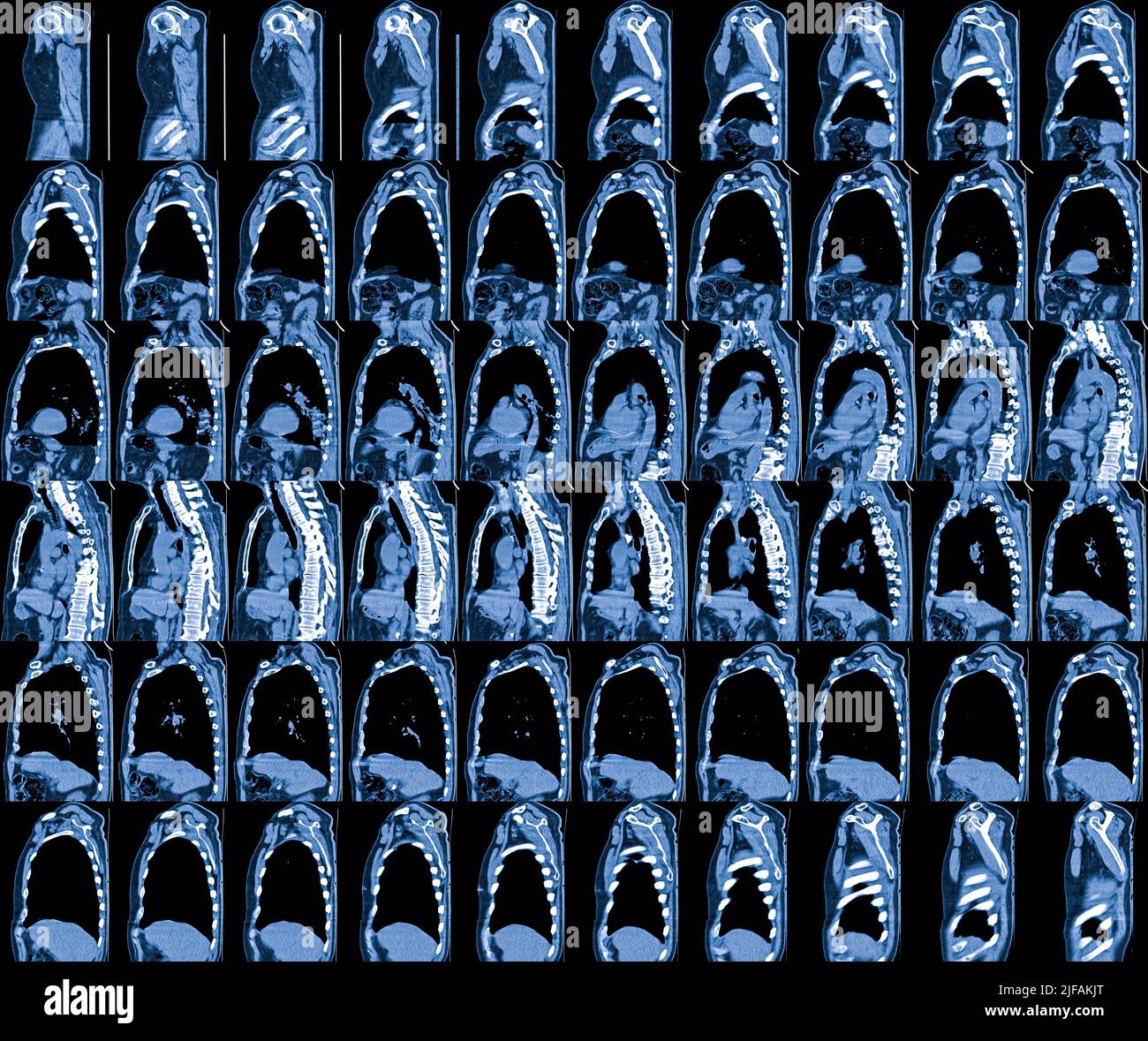 Magnetresonanzbild (MRT) von Brustorganen Stockfoto