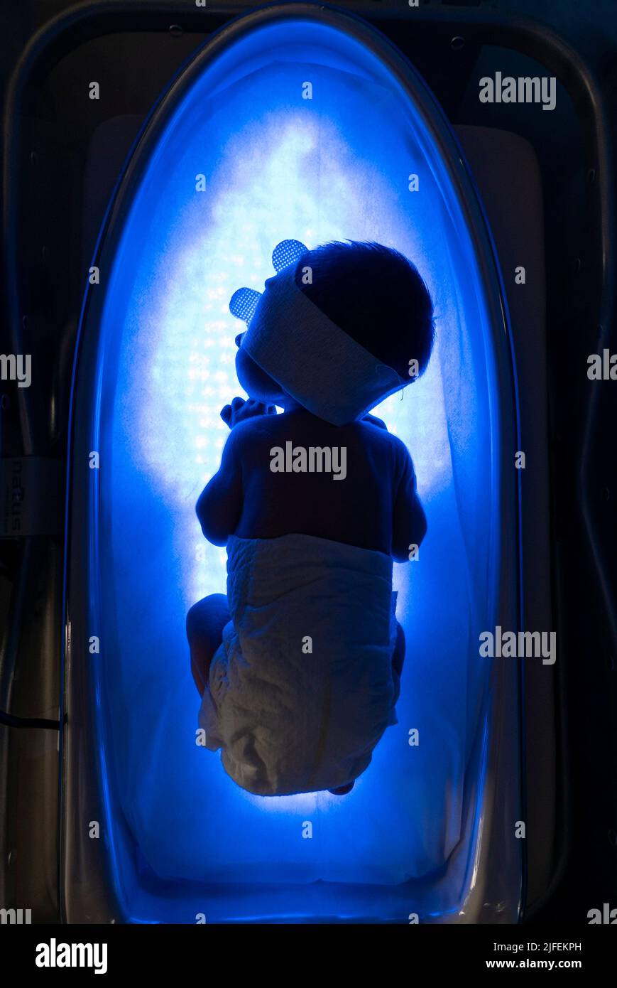 Neugeborenes Baby, das auf einem LED-Lichtbett liegt, um Gelbsucht zu behandeln Stockfoto