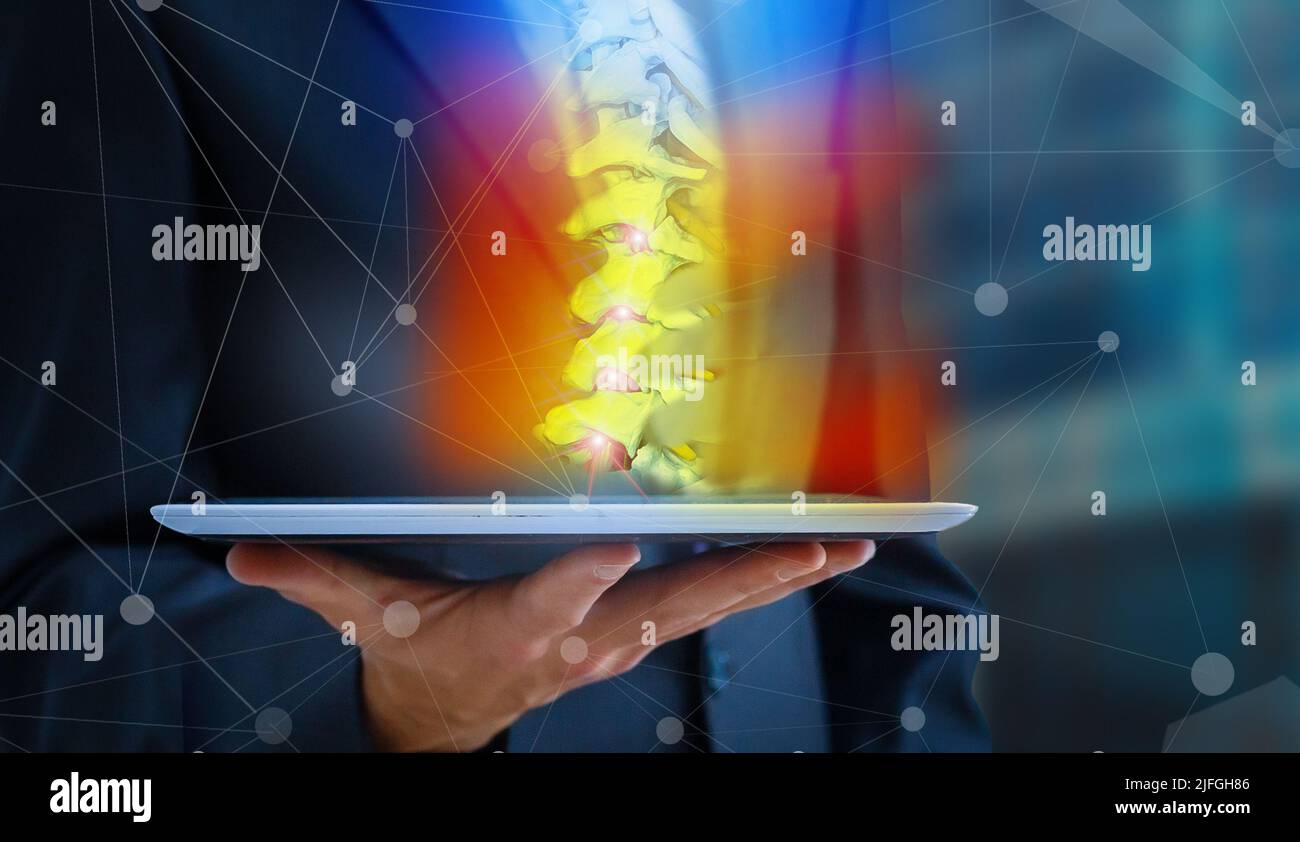 Arzt beobachtet eine Röntgenaufnahme von Hüfte und Wirbelsäule auf Rückenschmerzen auf einem digitalen Tablet. Stockfoto