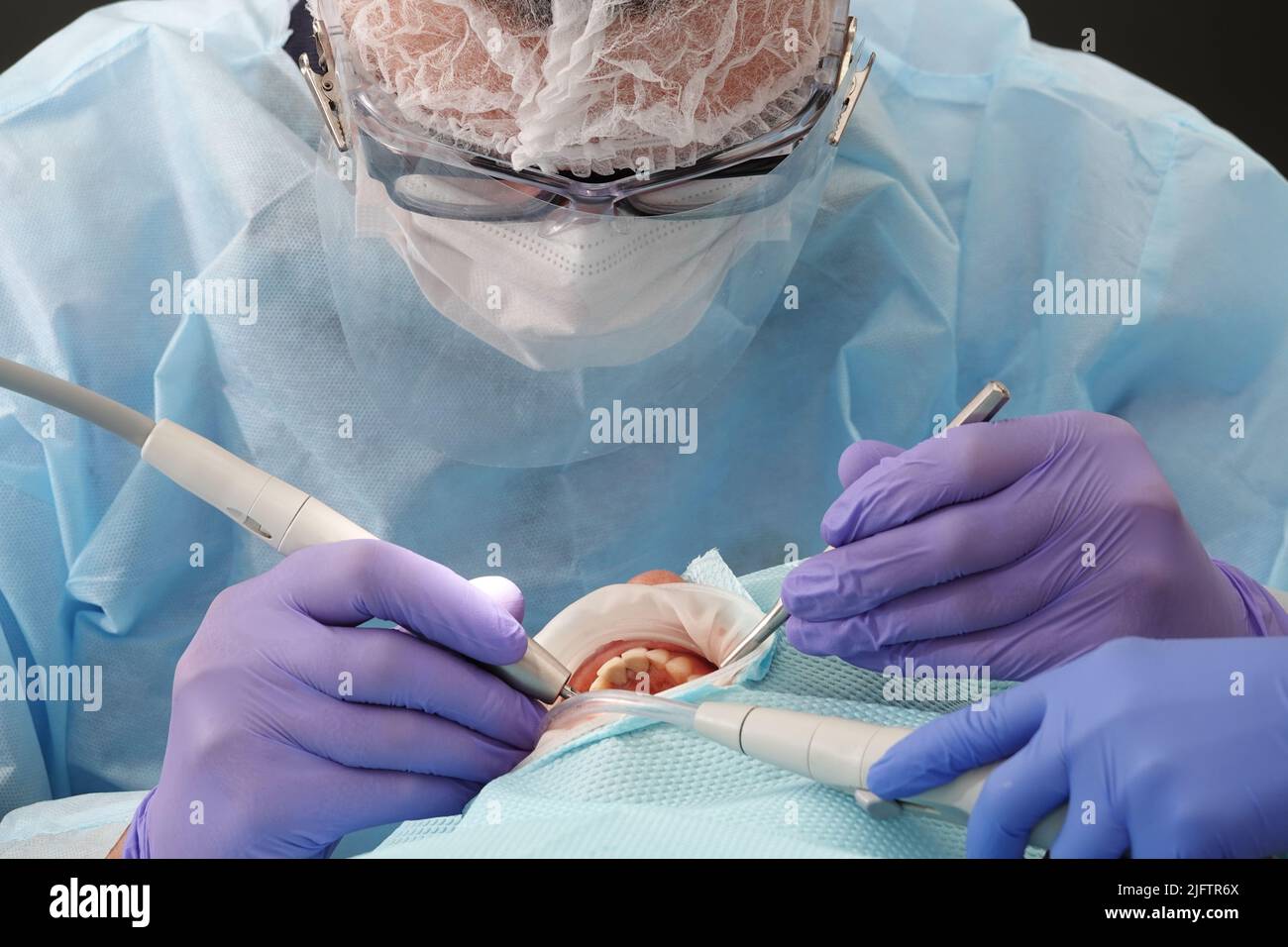Kiew, Ukraine 22. August 2020: Der Zahnarztarzt arbeitet mit einem Patienten aus der Nähe Stockfoto