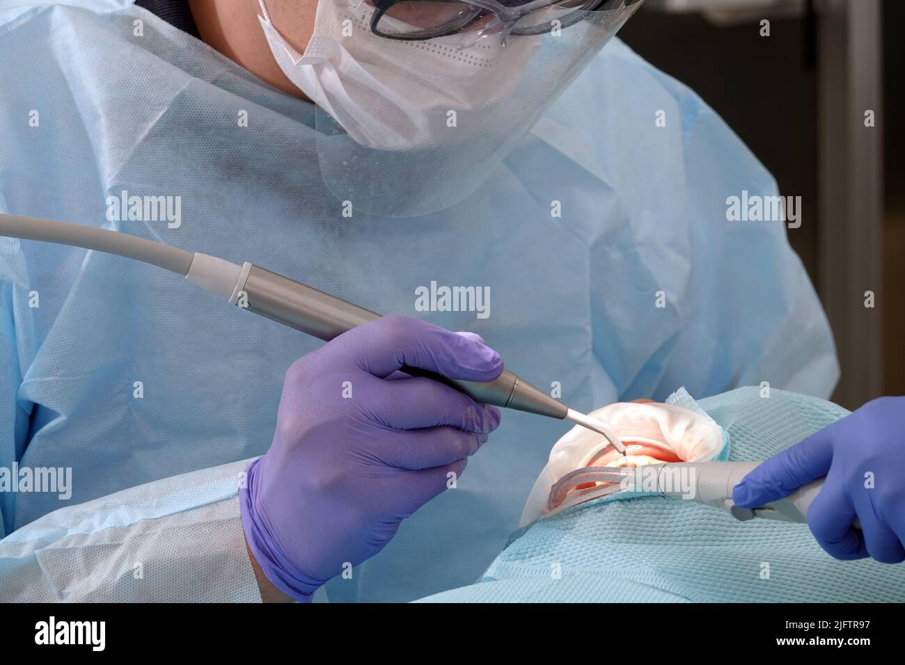 Kiew, Ukraine 22. August 2020: Der Zahnarztarzt arbeitet mit einem Patienten aus der Nähe Stockfoto
