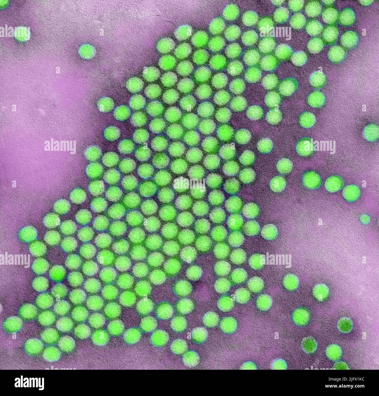 Dieses transmissionselektronenmikroskopische (TEM) Negativbild zeigt einige der ultrastrukturellen Merkmale, die durch eine Gruppe von Ikosaedral-förmigen Polio-Virus-Partikeln gezeigt werden. Digital koloriertes /Falschfarbenbild. Eine optimierte und verbesserte Version eines Bildes, das von den US Centers for Disease Control and Prevention / Credit CDC / J.J. Esposito; F.A.Murphy produziert wurde Stockfoto