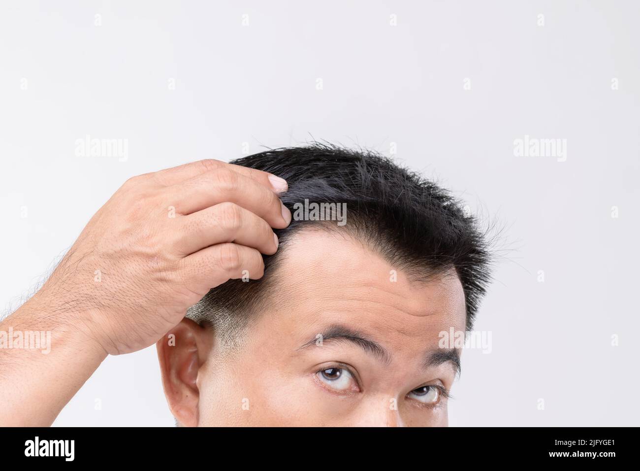 Portrait Asian Mann mit Sorge Gefühl und berühren auf seinem Kopf, um Glatze oder glabrous Problem zeigen. Studio-Aufnahmen mit Kopierbereich und grauem Hintergrund Stockfoto