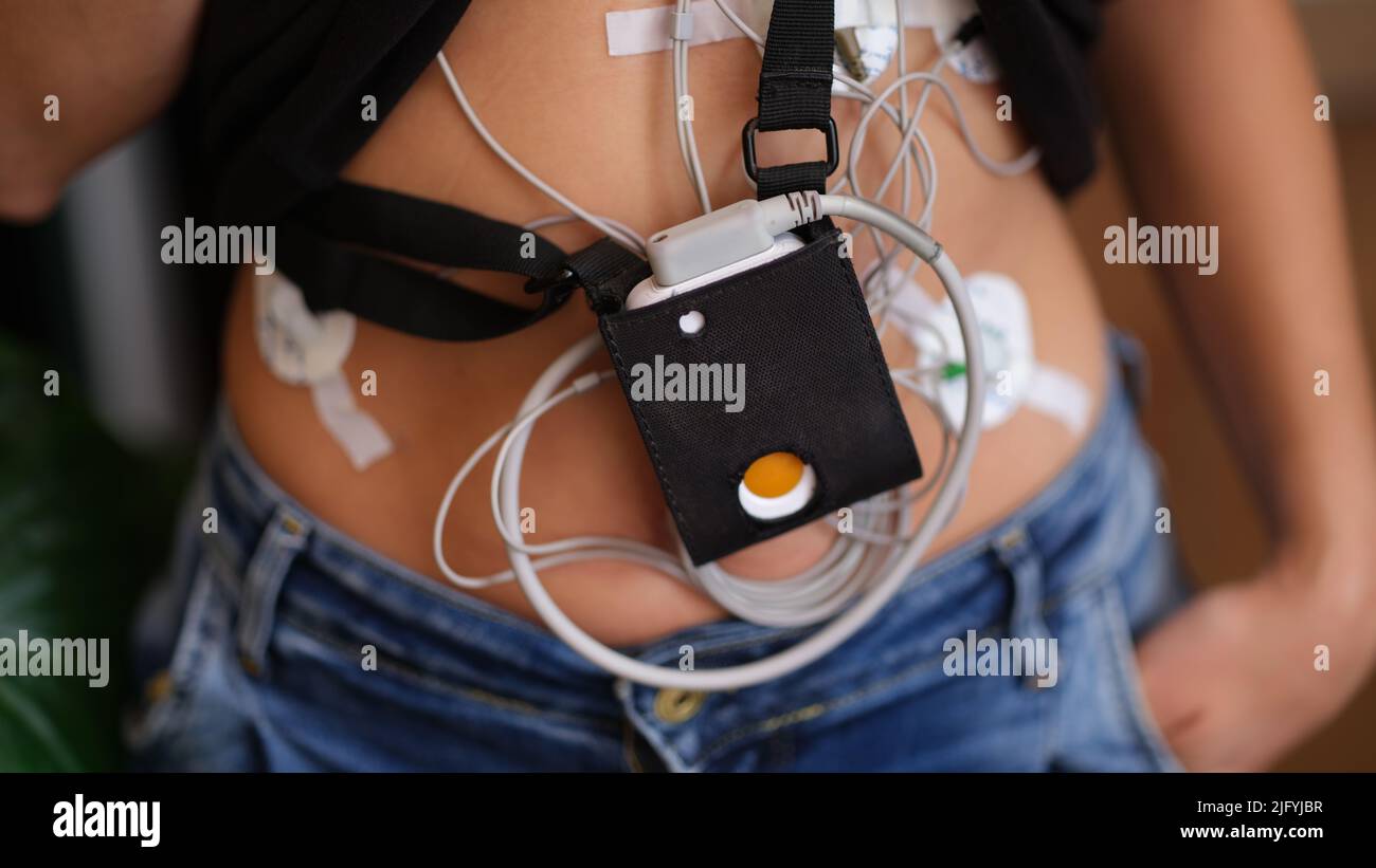 Patient steht mit nahaufnahme des holter-Elektrokardiogrammmonitors Stockfoto