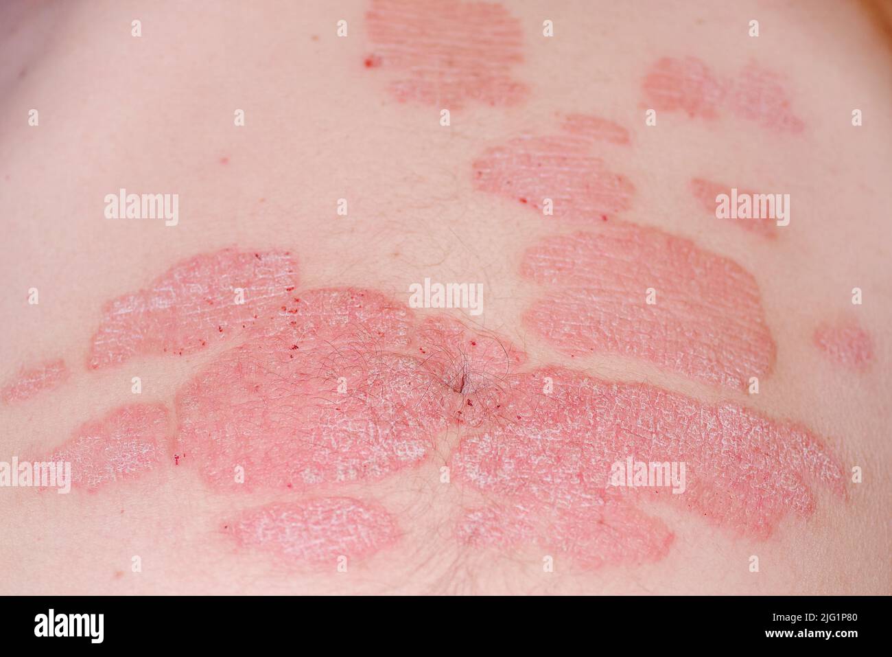 Splitter haut -Fotos und -Bildmaterial in hoher Auflösung – Alamy