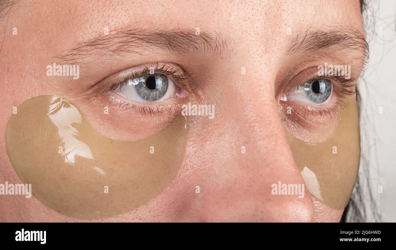 Frau mit Augenflecken Nahaufnahme, Schönheit Hautpflege. Stockfoto