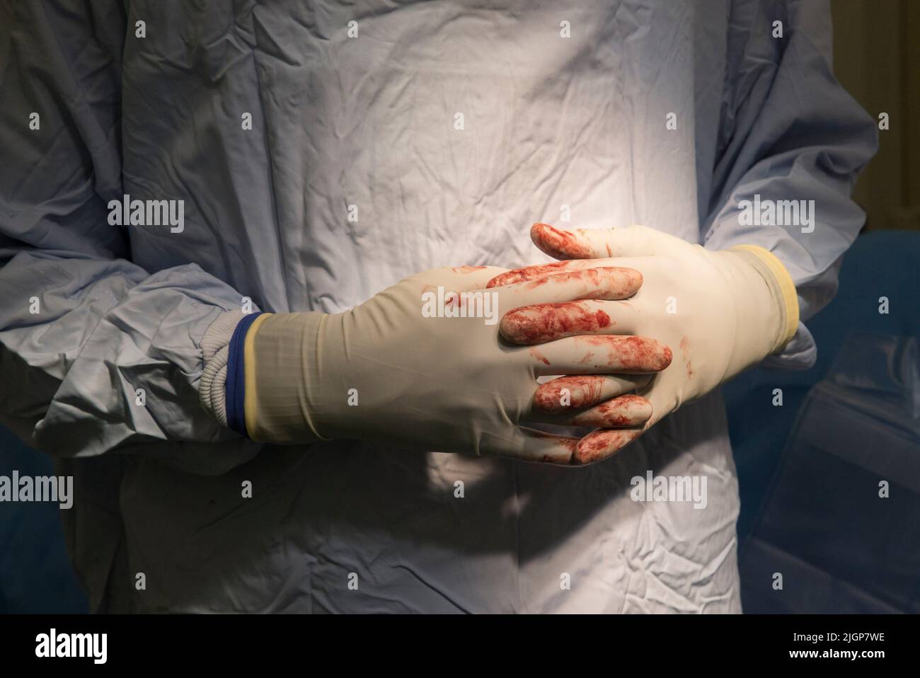 Nahaufnahme der Hände eines Chirurgen während einer NHS-Operation. Er führt eine Knieoperation durch und seine Handschuhe sind mit Blut befleckt. Stockfoto