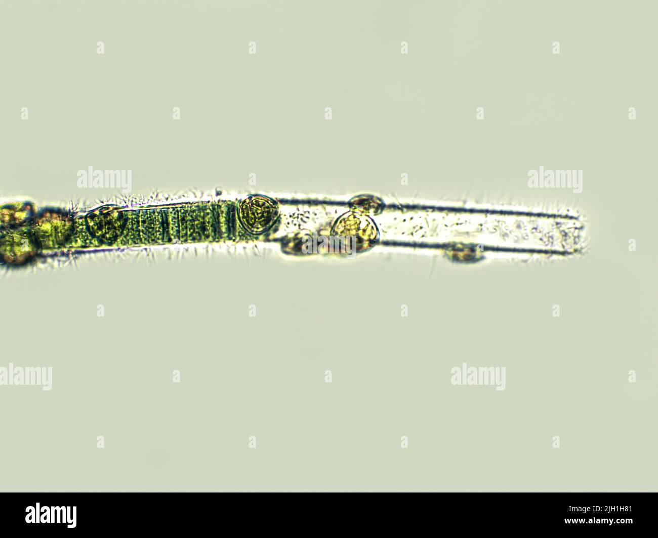 Blaugrüne Filamentalgen unter mikroskopischer Ansicht Stockfoto