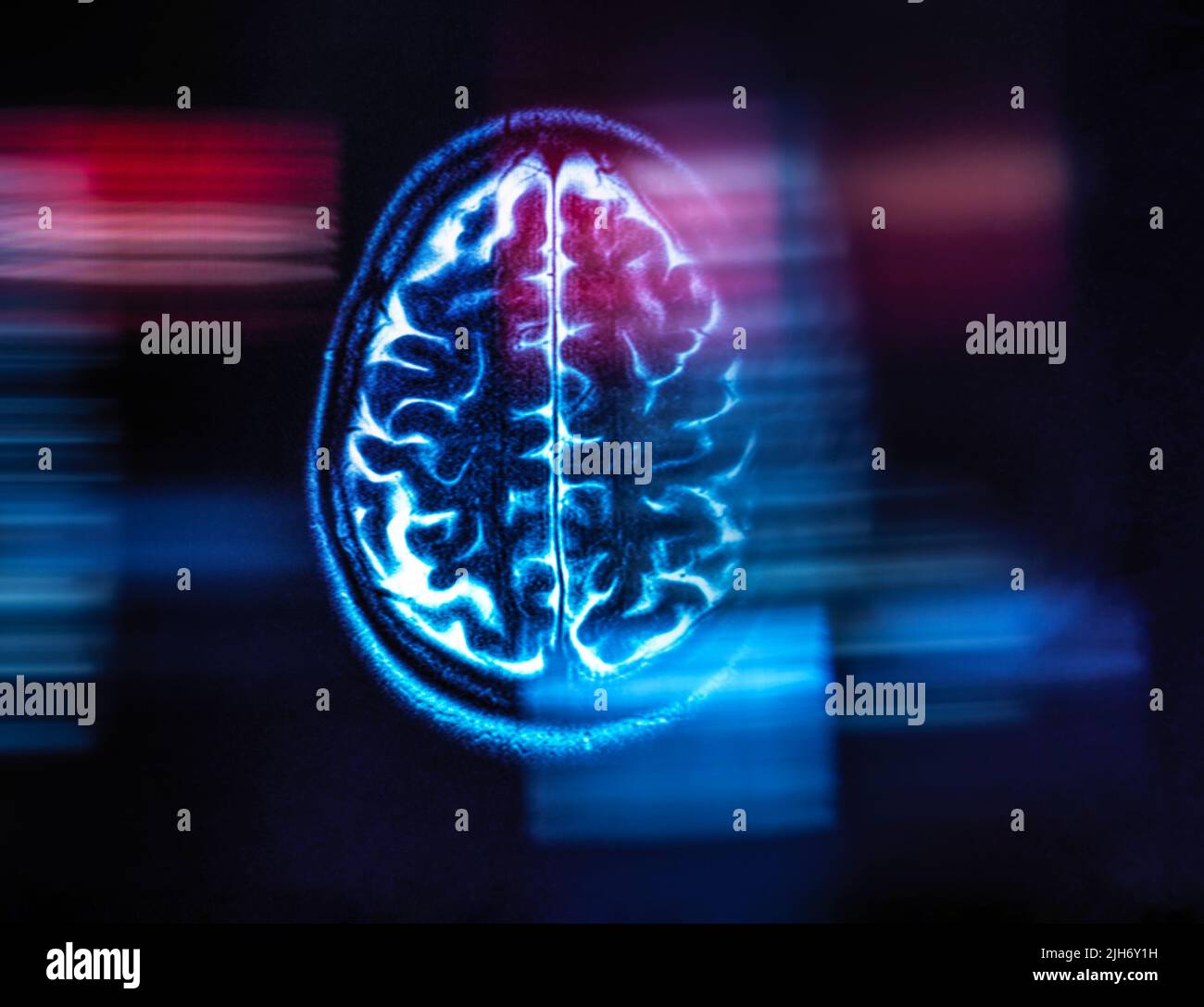 Alzheimer- und Demenzforschung, konzeptuelles Bild Stockfoto