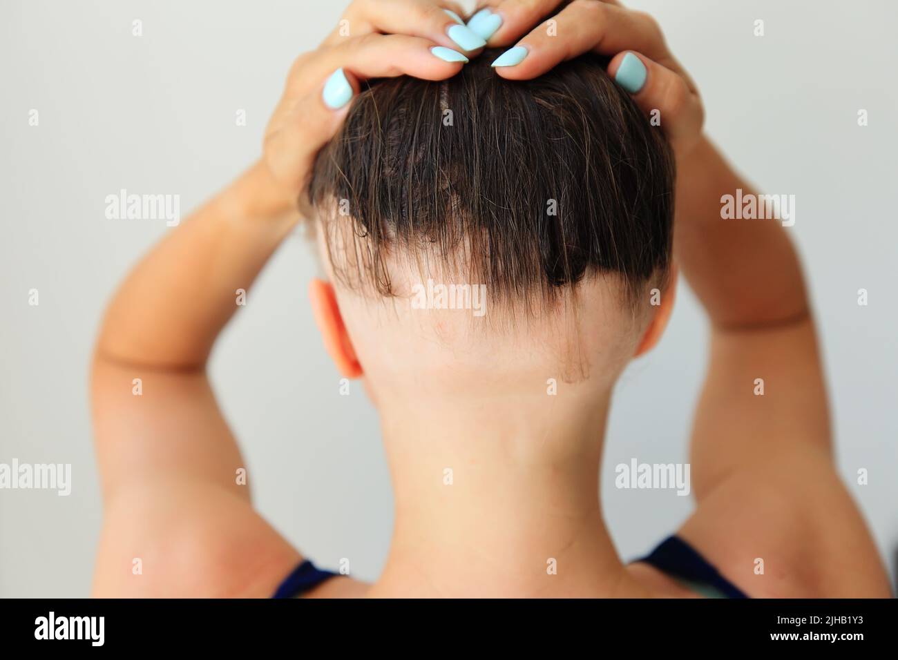 Kahle Stelle Am Kopf Frau Ursachen www.alamy.de