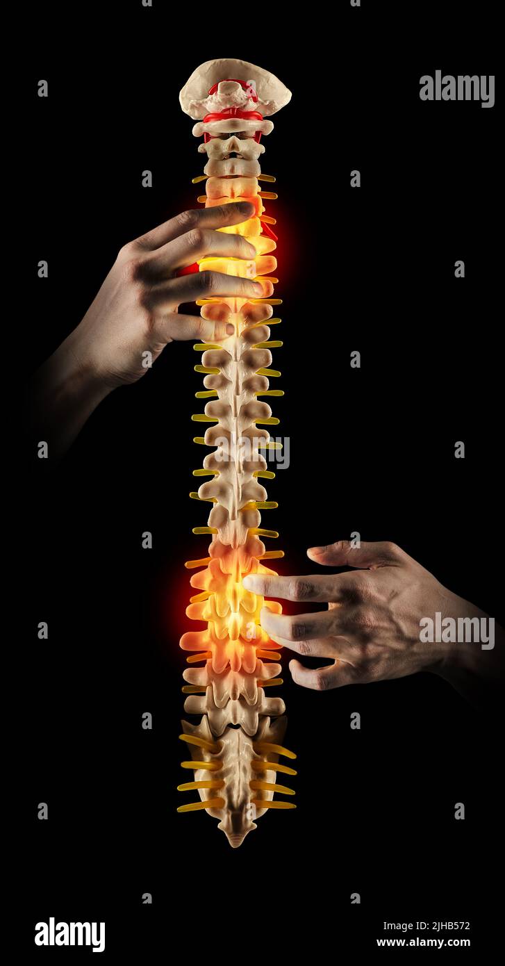 Chiropraktik, Konzept. Professioneller Chiropraktiker, der die Wirbelsäule eines Patienten mit Rückenschmerzen mittels manueller Therapie behandelt. Integrität des Backbones Stockfoto