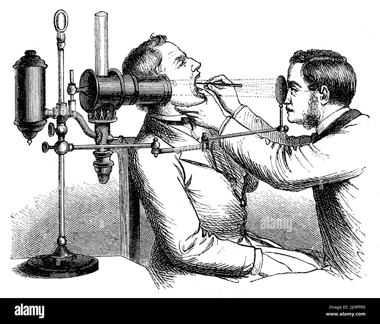 Historische Illustration der Medizin eines Kehlkopfes, Betrachtung mit Licht, Medizin / Historical Illustration of the Medication of a Larynx, Viewing with light, Medicine, Historisch, digital restaurierte Reproduktion einer Originalvorlage aus dem 19. Jahrhundert, das Originaldatum nicht bekannt, Stockfoto
