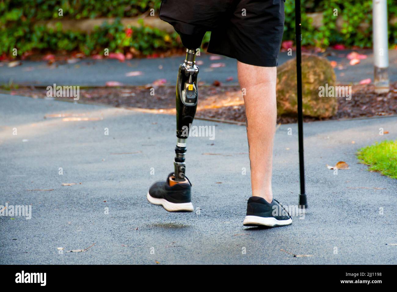 Mann, der mit einem prothetischen Bein läuft Stockfoto