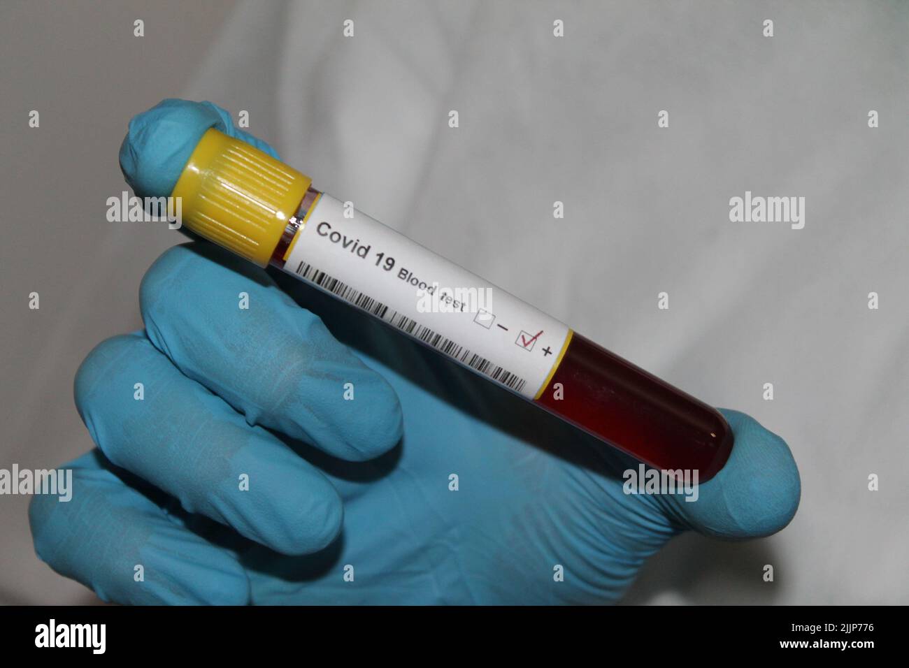 Ein Arzt in medizinischen Handschuhen hält einen Coronavirus-Positivtest in der Hand Stockfoto