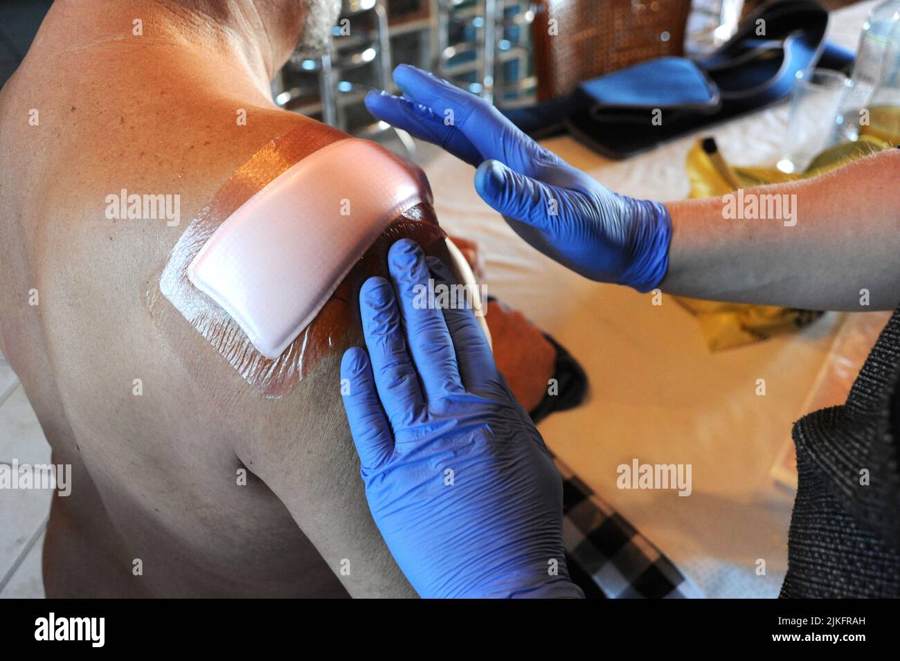 Liberale Krankenschwester führt eine Bandage nach Schulteroperation, Prothesenanpassung. Stockfoto