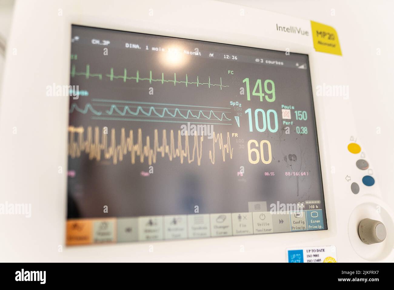 Säugling in Reanimation zur Behandlung von Bronchiolitis in einer pädiatrischen Notaufnahme eines Krankenhauses. Stockfoto