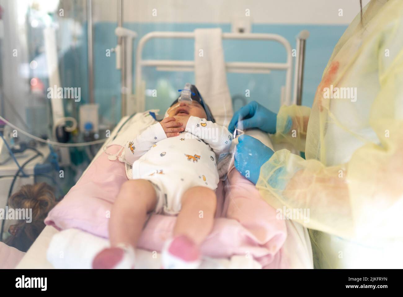 Bronchiolitis-Epidemie in einer pädiatrischen Krankenstation. Stockfoto