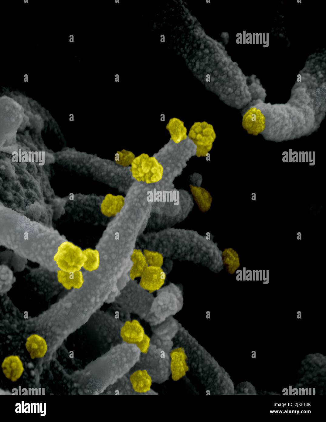 Dieses Rasterelektronenmikroskop-Bild zeigt SARS-CoV-2 (runde gelbe Partikel), die aus der Oberfläche einer im Labor kultivierten Zelle hervorgehen. SARS-CoV-2, auch bekannt als 2019-nCoV, ist das Virus, das COVID-19 verursacht. Aufnahme und Farbgebung in den Rocky Mountain Laboratories in Hamilton, Montana. Kredit: NIAID Stockfoto