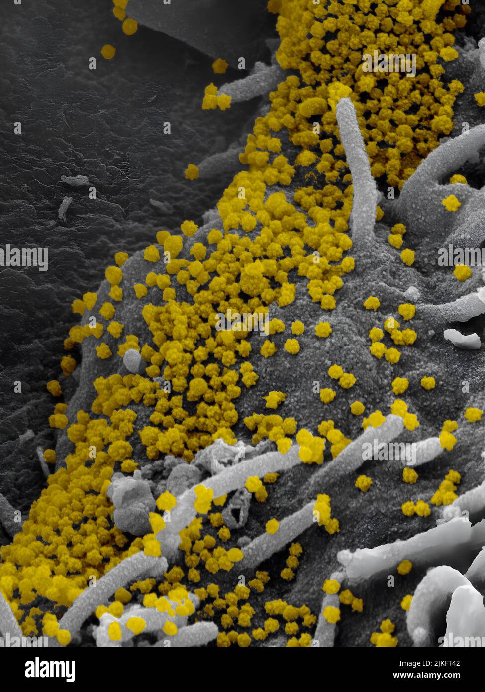 Dieses Rasterelektronenmikroskop-Bild zeigt SARS-CoV-2 (runde Goldpartikel), die aus der Oberfläche einer im Labor kultivierten Zelle hervorgehen. SARS-CoV-2, auch bekannt als 2019-nCoV, ist das Virus, das COVID-19 verursacht. Aufnahme und Farbgebung in den Rocky Mountain Laboratories in Hamilton, Montana. Kredit: NIAID Stockfoto