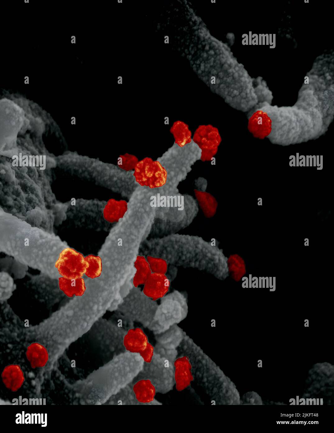 Dieses Rasterelektronenmikroskop-Bild zeigt SARS-CoV-2 (runde rote Partikel), die aus der Oberfläche einer im Labor kultivierten Zelle hervorgehen. SARS-CoV-2, auch bekannt als 2019-nCoV, ist das Virus, das COVID-19 verursacht. Aufnahme und Farbgebung in den Rocky Mountain Laboratories in Hamilton, Montana. Kredit: NIAID Stockfoto