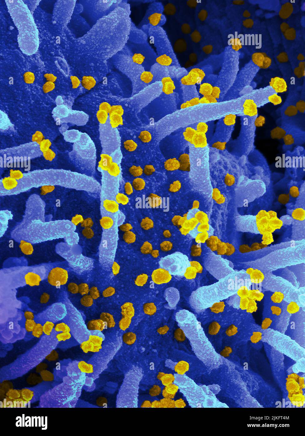 Dieses Rasterelektronenmikroskop-Bild zeigt SARS-CoV-2 (runde Goldpartikel), die aus der Oberfläche einer im Labor kultivierten Zelle hervorgehen. SARS-CoV-2, auch bekannt als 2019-nCoV, ist das Virus, das COVID-19 verursacht. Aufnahme und Farbgebung in den Rocky Mountain Laboratories in Hamilton, Montana. Kredit: NIAID Stockfoto
