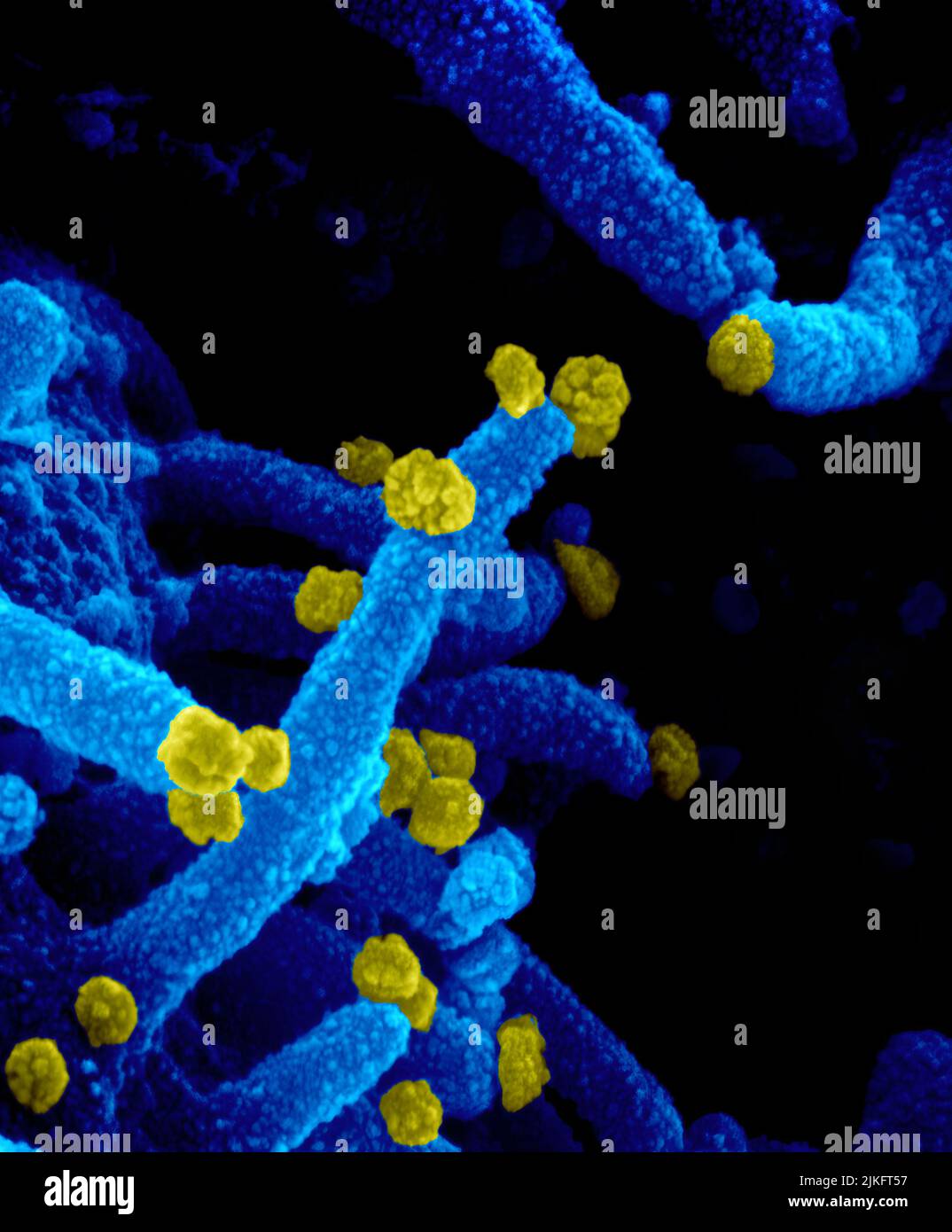 Dieses Rasterelektronenmikroskop-Bild zeigt SARS-CoV-2 (runde gelbe Partikel), die aus der Oberfläche einer im Labor kultivierten Zelle hervorgehen. SARS-CoV-2, auch bekannt als 2019-nCoV, ist das Virus, das COVID-19 verursacht. Aufnahme und Farbgebung in den Rocky Mountain Laboratories in Hamilton, Montana. Kredit: NIAID Stockfoto