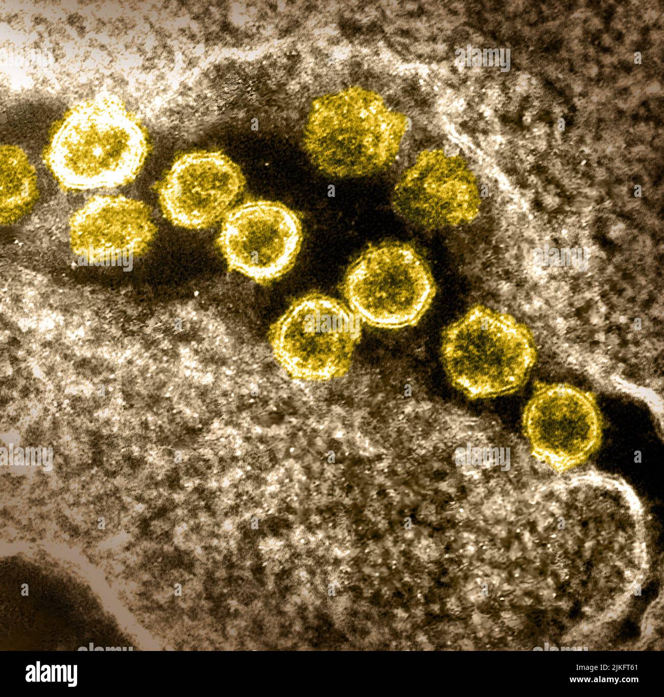 Dieses Transmissions-Elektronenmikroskop-Bild zeigt SARS-CoV-2, auch bekannt als 2019-nCoV, das Virus, das COVID-19 verursacht. Viruspartikel entstehen aus der Oberfläche einer im Labor kultivierten Zelle. Spitzen am äußeren Rand von Viruspartikeln geben Coronaviren ihren Namen, geformt wie eine Krone. Aufnahme und Farbgebung in den Rocky Mountain Laboratories in Hamilton, Montana. Kredit: NIAID Stockfoto