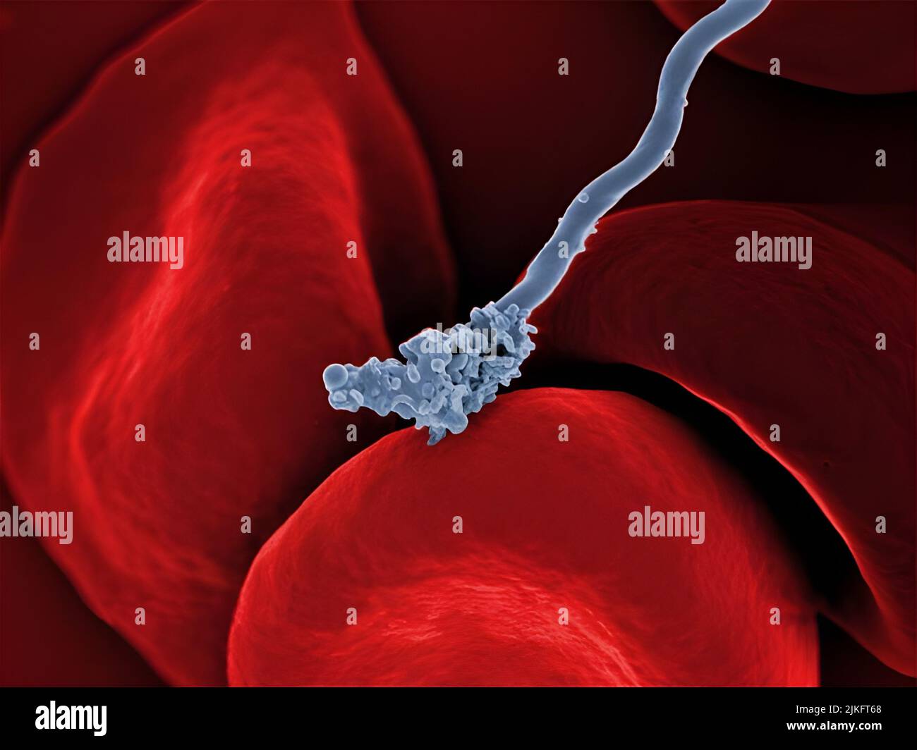 Rasterelektronenmikrographie von Borrelia hermsii, dem Erreger von schubdem Fieber, das mit roten Blutkörperchen interagiert. Stockfoto