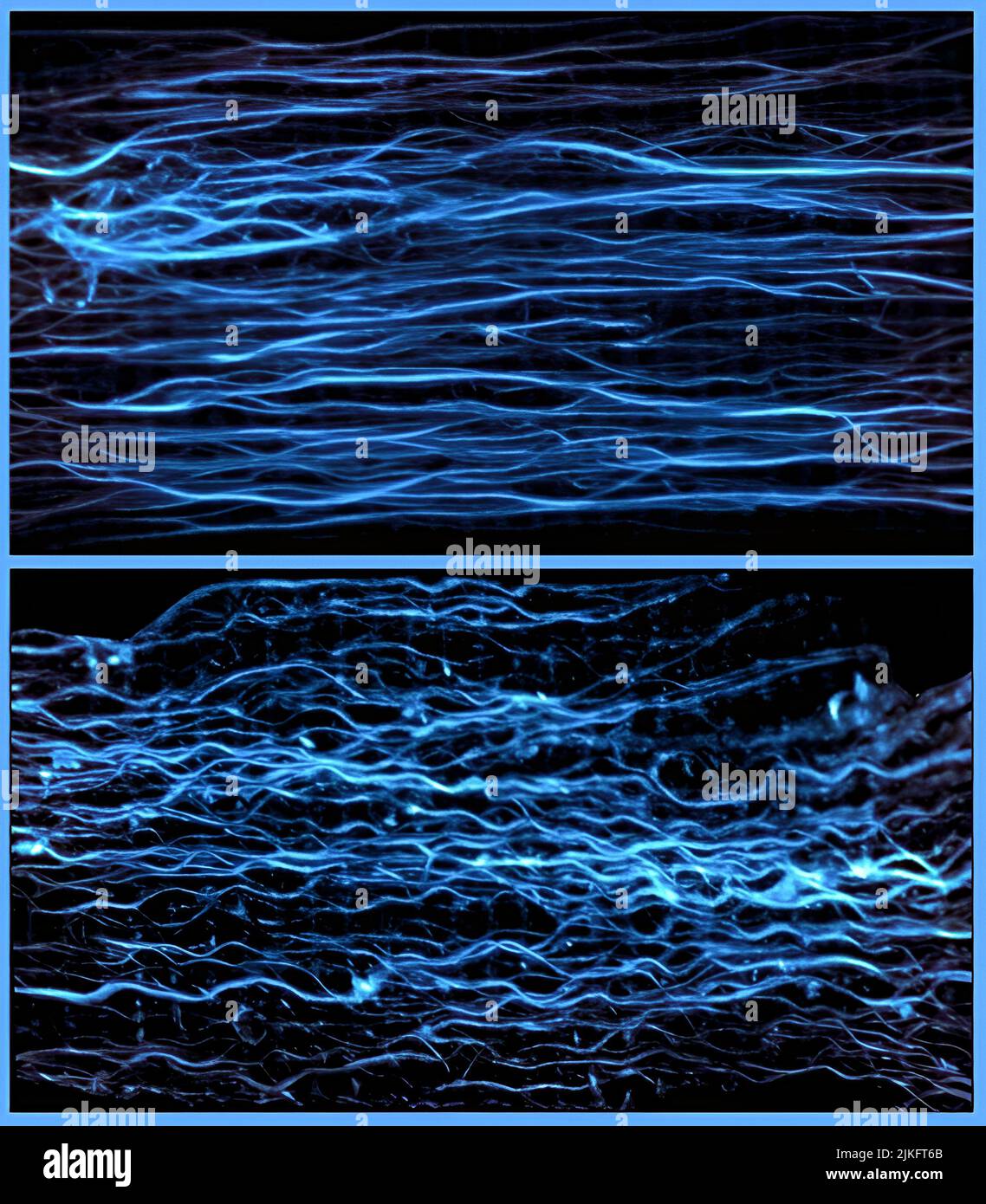 Kontraktion von Mikrotubuli. Oben, Mikrotubuli (blau) in einer ruhenden Herzmuskelzelle. Unterer, zugezogener Mikrotubuli (blau) in einer sich bewegenden Herzmuskelzelle. Stockfoto