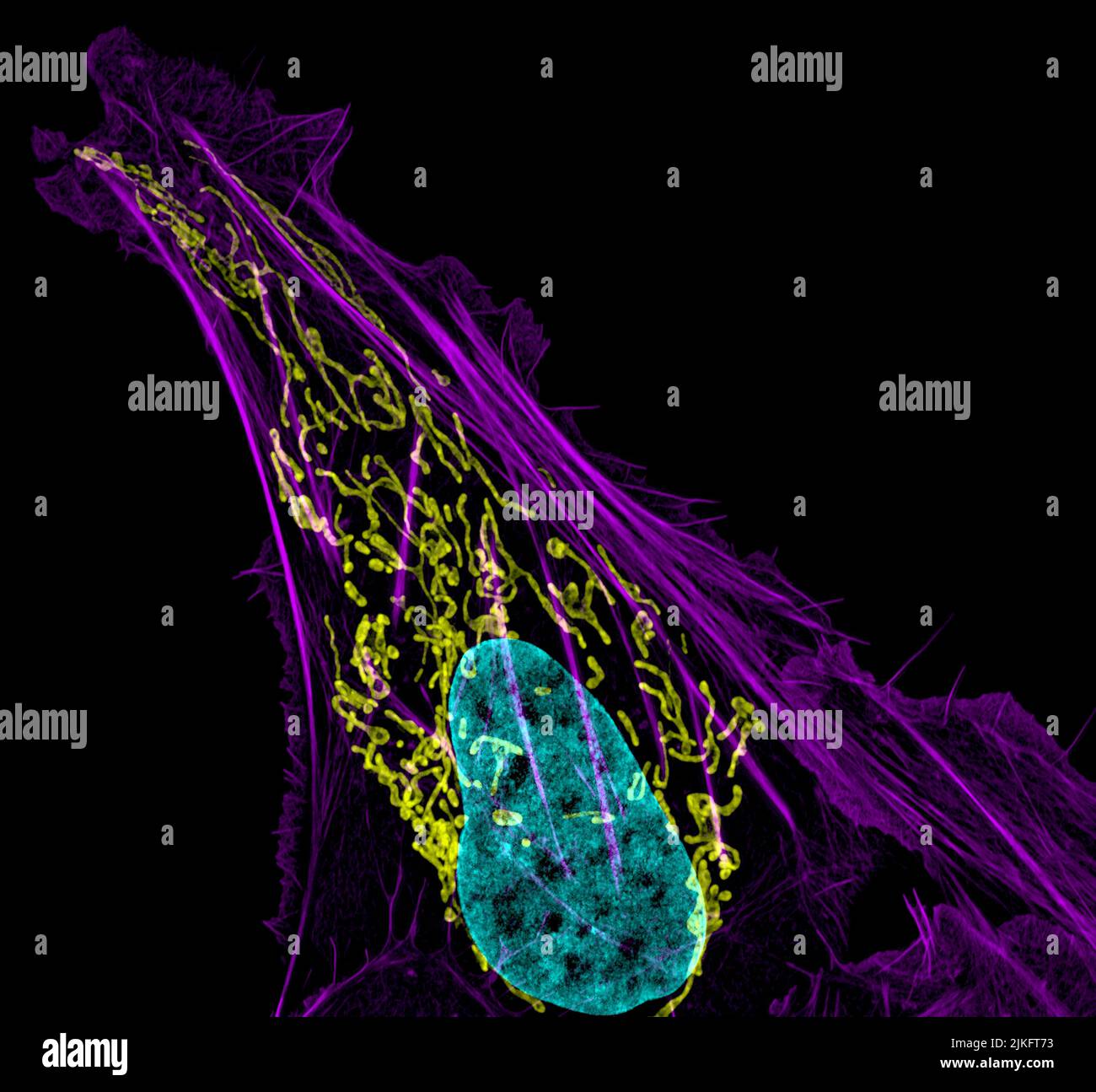 Dieses Bild zeigt eine Osteosarkomzelle mit DNA in Blau, Energiefabriken (Mitochondrien) in Gelb und Aktinfilamenten, Teil des Zellskeletts, in Violett. Das Osteosarkom, eines der seltenen Krebsarten, die in den Knochen entstehen, ist extrem selten, wobei in den Vereinigten Staaten jedes Jahr weniger als tausend neue Fälle ausgelöst werden. Stockfoto