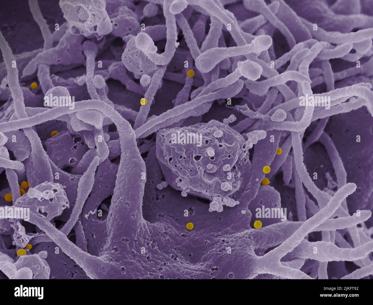 Rasterelektronenmikroskopische Aufnahme von Virus-Partikeln des Krim-Kongo-Hämorrhagiefiebers (CCHF) (gelb), die von der Oberfläche kultivierter Epithelzellen eines Patienten aufkeimend sind. Stockfoto