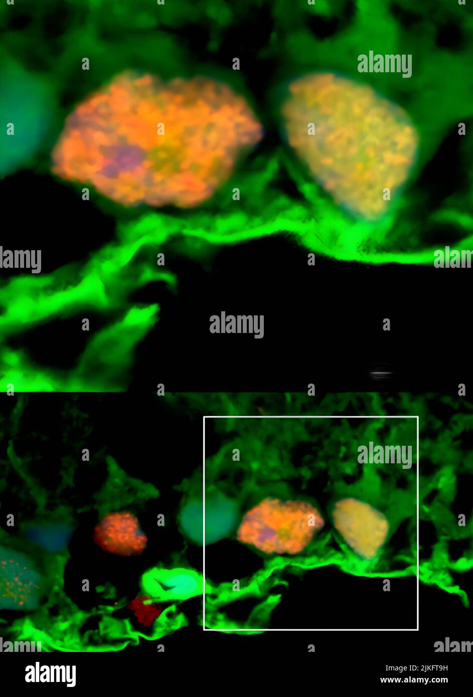 Eine neue Studie an Ratten zeigt, dass Stammzellsekrete, sogenannte Exosomen, Zellen in der Netzhaut, dem lichtempfindlichen Gewebe am Augenhintergrund, zu schützen scheinen. Die Studie wurde von Forschern des National Eye Institute (NEI) durchgeführt, das zu den National Institutes of Health gehört. Stockfoto