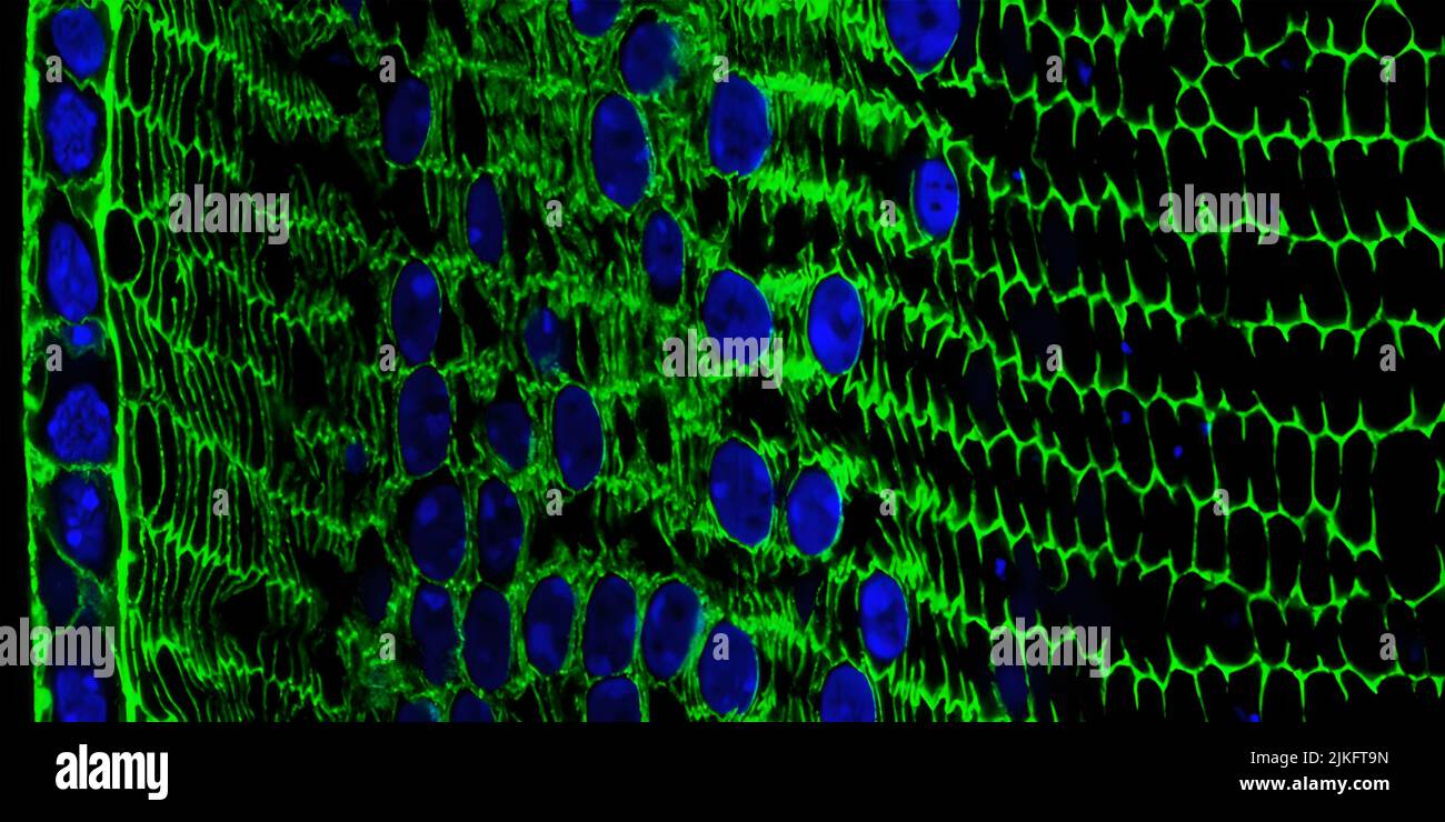 Hier sehen Sie den Entwicklungsprozess der Linse in einem Gewebequerschnitt einer erwachsenen Maus. Bei Mäusen wie beim Menschen entstehen durch eine einzige Schicht von stabartigen Epithelzellen (ganz links, blau/grün) lebenslang spezialisierte Linsenzellen (Mitte, blau/grün). Die neuen Zellen ähneln ihren Vorläuferzellen, mit den Kernen (blau) und dem Zytoskelett-Protein Actin (grün). Aber bald werden diese Zellen große Mengen wasserlöslicher Proteine produzieren, die als kristalline Proteine bezeichnet werden, um ihre Transparenz zu verbessern, während sie ihre Kerne allmählich auflösen, um die Lichtstreuungsmasse zu beseitigen. Stockfoto