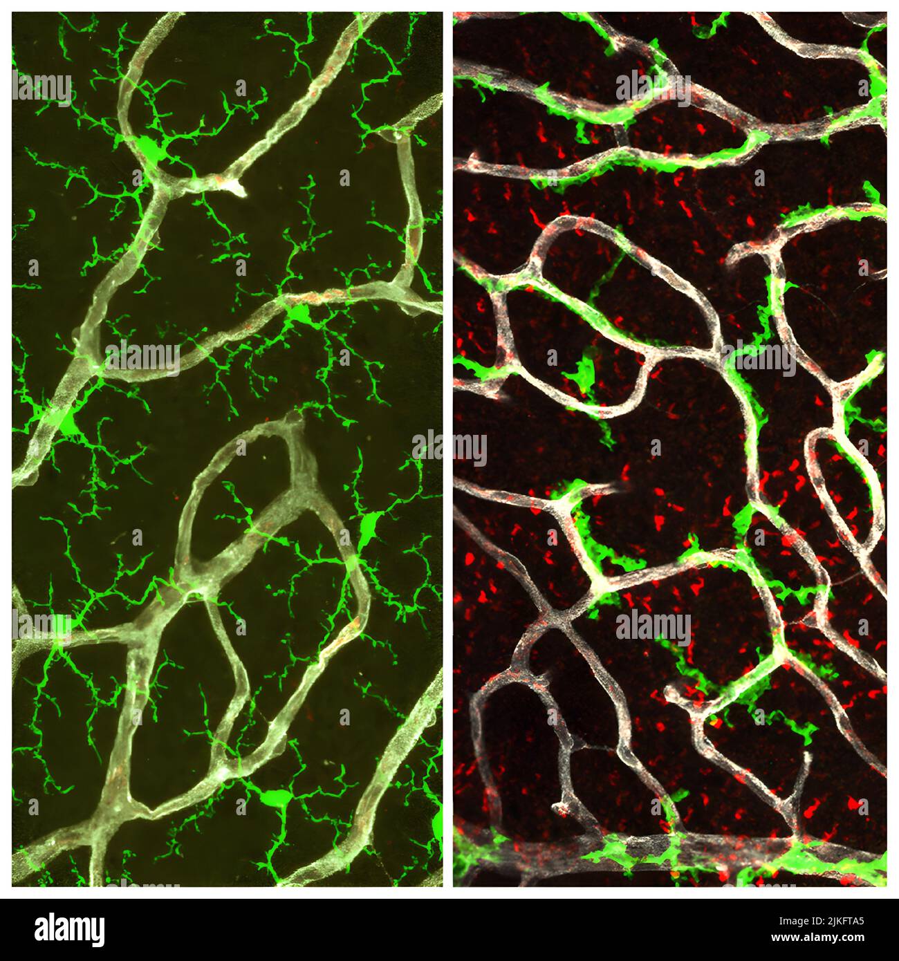 Bei gesunder Netzhaut (links) haben Mikroglia (grün) eine verzweigte Struktur, die die Netzhaut bedeckt. Ohne TGF-Signalisierung (rechts) verlieren Mikroglia ihre verzweigte Struktur und binden sich an Blutgefäße (weiß). M'llers Gliafolge wurde anormal und erwarb Aktivierungsmarker (rot). Stockfoto