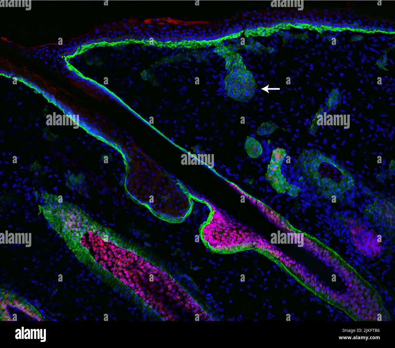 NIAMS-finanzierte Forscher haben herausgefunden, dass zwei entgegengesetzte Signalwege die Bildung von Körperhaar und Schweißdrüsen bestimmen. Bei der Entwicklung (embryonaler) menschlicher Haut bilden sich zuerst Haarfollikel (rosa) und später Schweißdrüsen (Pfeil). Die Studie kann Forschern helfen, Hauttransplantate für Brandopfer und Menschen mit bestimmten genetischen Störungen zu verbessern. Stockfoto
