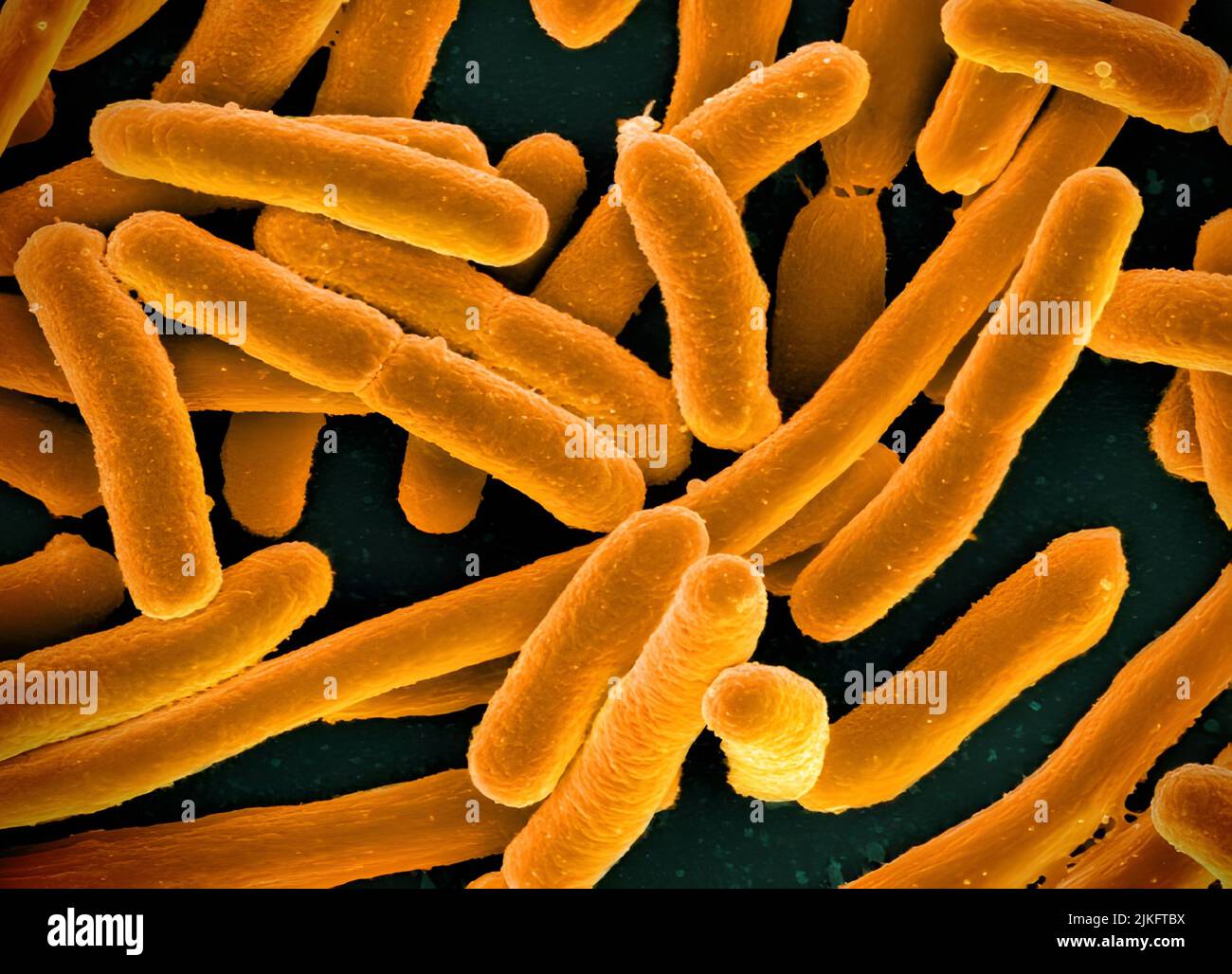Eingefärbte Rasterelektronenmikrographie von Escherichia, in Kultur gewachsen und auf eine Deckschicht geklebt. Stockfoto
