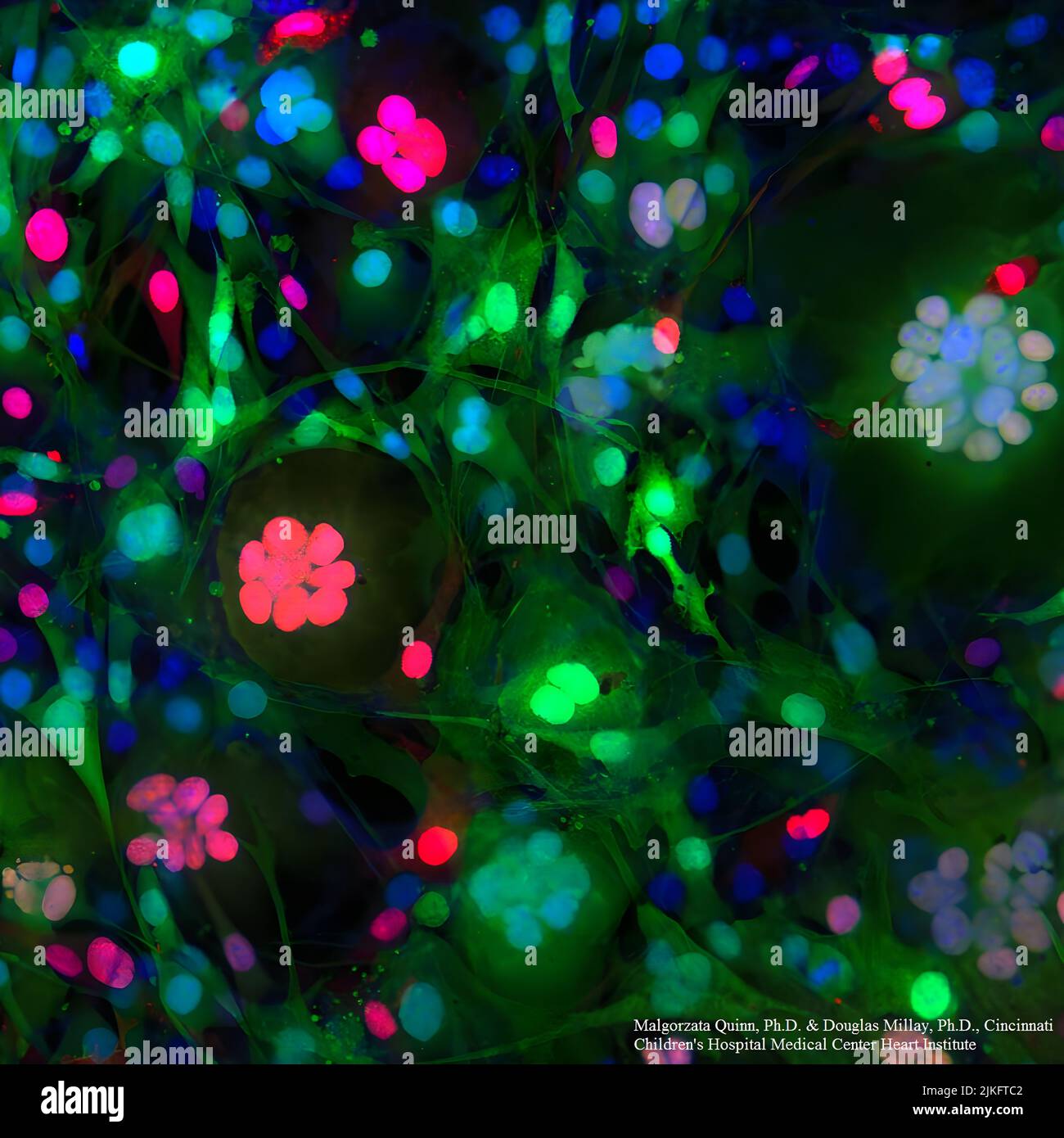 Unreife Muskelzellen verschmelzen während der Entwicklung zu langen Muskelfasern mit vielen Kernen. Um die am Fusionsprozess beteiligten Faktoren zu identifizieren, untersuchten die Wissenschaftler Fibroblasten-Zellen, die nicht normal verschmelzen. Wie im mikroskopischen Bild gezeigt, führt das Hinzufügen eines Gens, das ein Protein namens Myomerger zu Fibroblasten macht, dazu, dass sie zu Clustern fluoreszenzgefärbter Zellkerne verschmelzen. Das Protein arbeitet zusammen mit einem anderen Protein, genannt Myomaker, um Fusion zu verursachen. Stockfoto