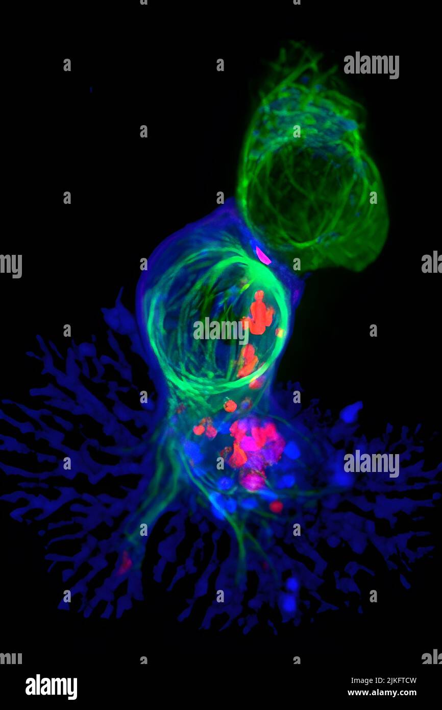 Eine der wichtigsten Rollen des Immunsystems ist die Reinigung des Körpers von Viren und Krebszellen. Diese Arbeit wird von Killer-T-Zellen durchgeführt, die Tumoren und virusinfizierte Zellen aufspüren und zerstören. In diesem Immunfluoreszenz-Bild greift eine Killer-T-Zelle (blau) eine Zielzelle an. Ein Fleck von Signalmolekülen (rosa), die sich an der Stelle des Zell-Zell-Kontakts versammeln, zeigt an, dass die CTL ein Ziel identifiziert hat. Lytische Granulate (rot), die zytotoxische Komponenten enthalten, reisen dann entlang des Mikrotubuli-Zytoskeletts (grün) zur Kontaktstelle und werden sekretiert, wodurch das Ziel getötet wird. Stockfoto