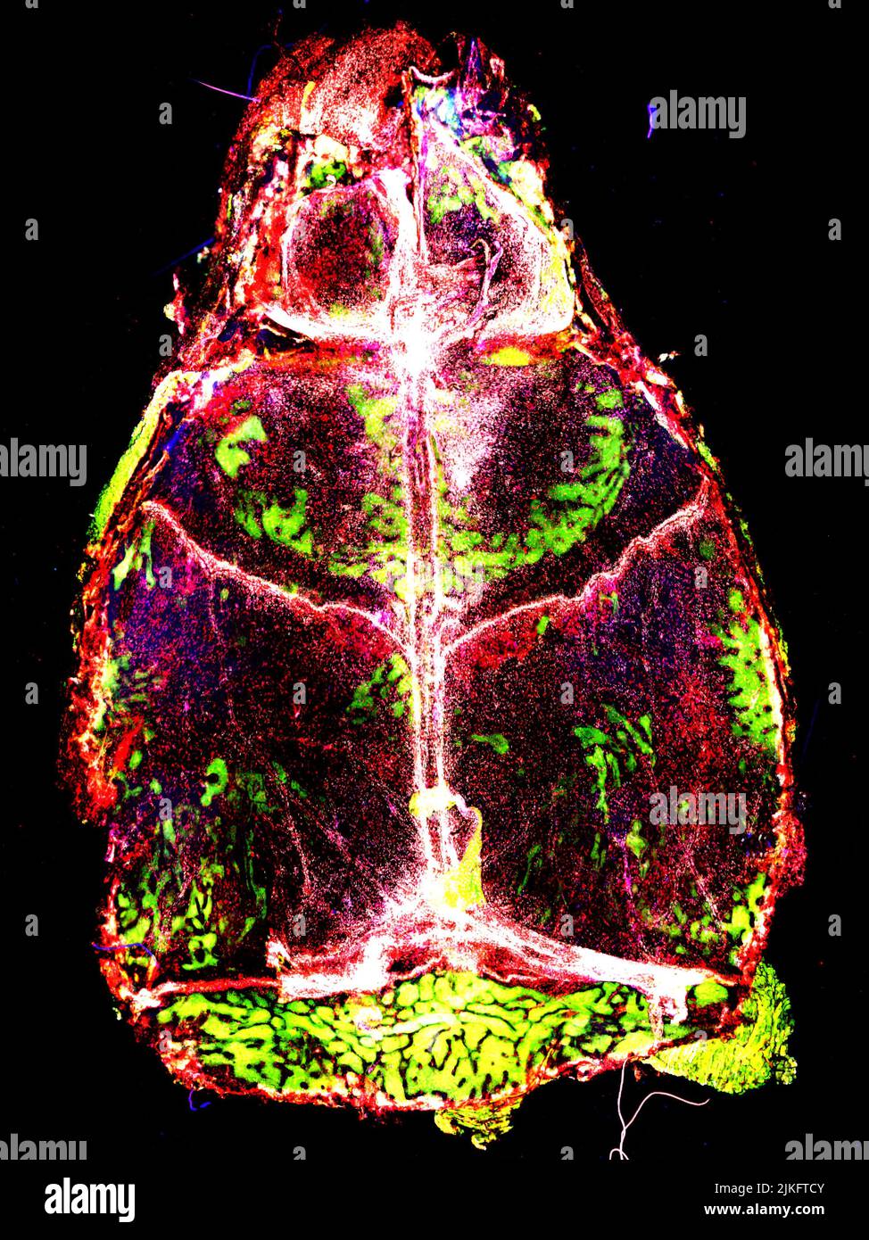 Meningeale Makrophagen (in weiß, rot und blau dargestellt) sind immer auf potenzielle Bedrohungen für Hirngewebe aufmerksam. Stockfoto