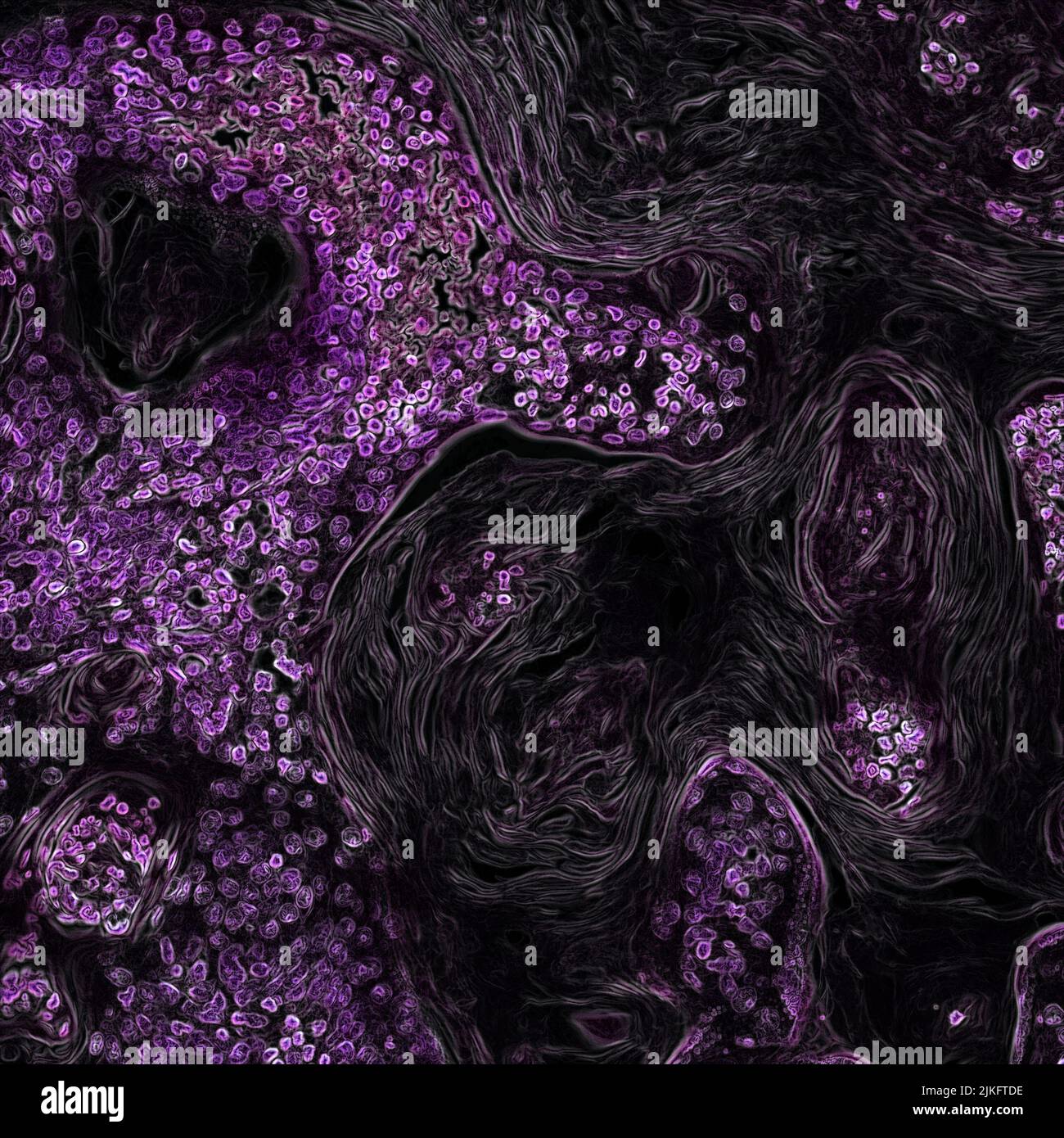 In diesem Bild eines genetisch veränderten Mausmodells ist Lungenkrebs, der durch das Onkogen Kras verursacht wird, violett dargestellt. Als Haupttreiber vieler Krebsarten ist das Kras-Gen ein vielversprechendes Ziel für neue Krebstherapien. Stockfoto