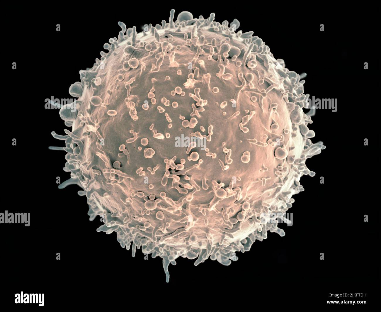 Koloriertes Rasterelektronenmikrograph einer B-Zelle eines menschlichen Spenders. Stockfoto