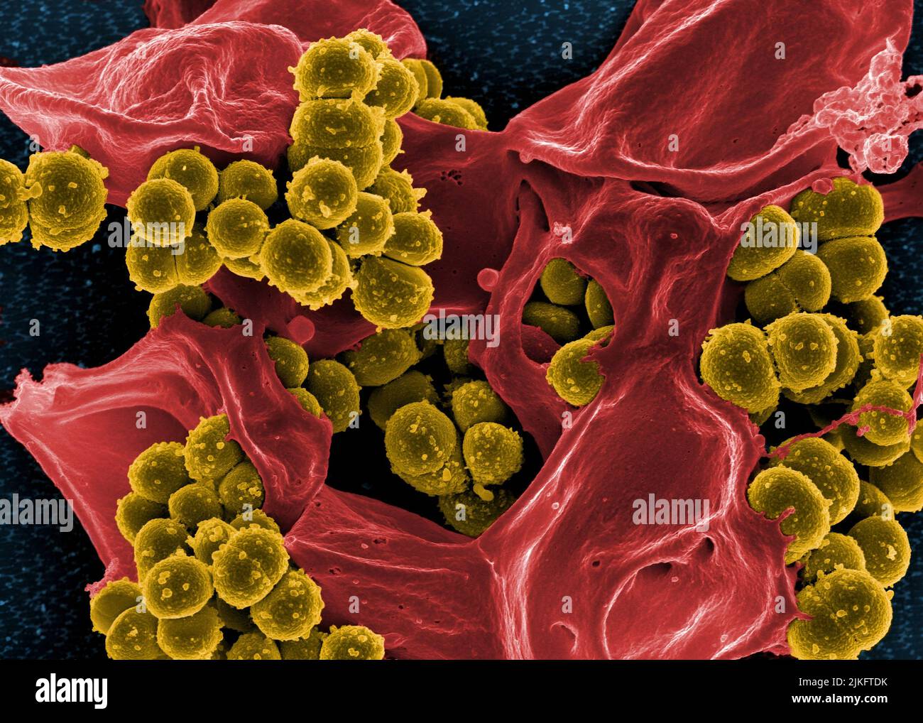Ron Staph White blood cell electron micrograph -Fotos und -Bildmaterial in hoher ...