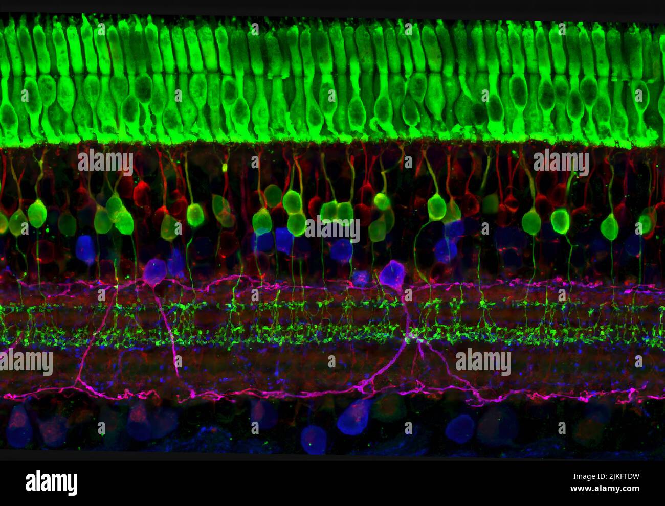Dieses Bild zeigt die vielen Schichten von Nervenzellen in der Netzhaut. Die obere (grüne) Schicht besteht aus Zellen, den sogenannten Photorezeptoren, die Licht in elektrische Signale umwandeln und an das Gehirn senden. Die beiden bekanntesten Arten von Photorezeptorzellen sind stabförmig und kegelförmig. Stäbe helfen uns bei schlechten Lichtverhältnissen zu sehen, aber können und Stockfoto