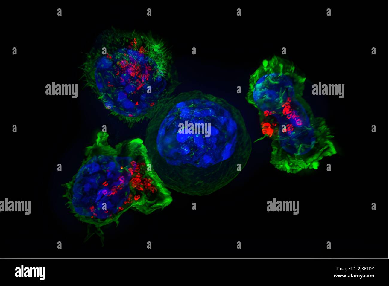 SuperResolution-Bild einer Gruppe von Killer-T-Zellen (grün und rot), die eine Krebszelle umhüllt (blau, Mitte). Wenn eine Killer-T-Zelle mit einer Zielzelle in Kontakt kommt, wird die Killerzelle angehängt und breitet sich auf das gefährliche Ziel aus. Die Killerzelle verwendet dann spezielle Chemikalien, die in Vesikeln (rot) untergebracht sind, um den tödlichen Schlag zu liefern. Dieses Ereignis wurde daher als „der Kuss des Todes“ bezeichnet. Sobald die Zielzelle getötet wurde, gehen die Killer-T-Zellen weiter, um das nächste Opfer zu finden. Stockfoto