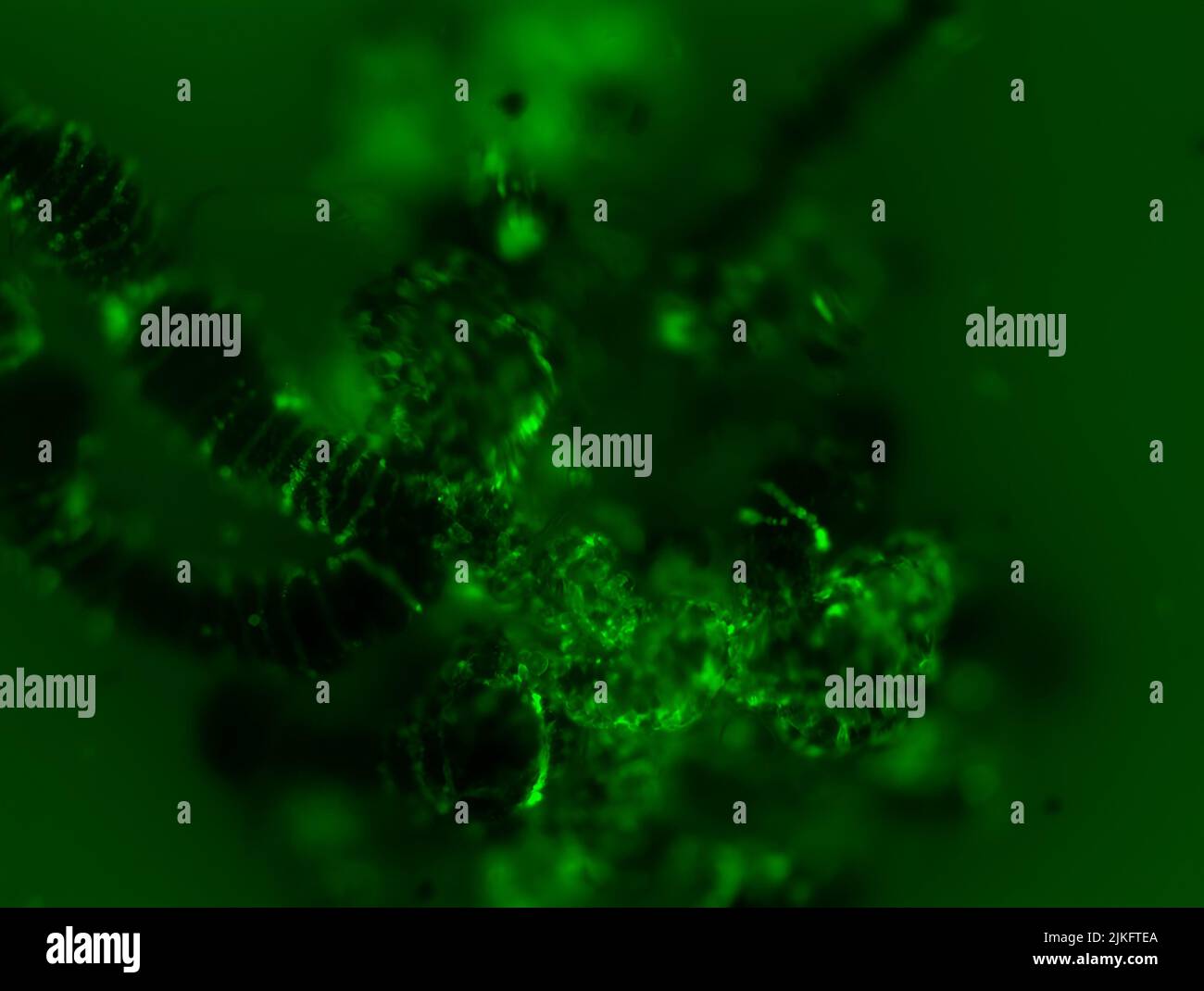 In diesem Fluoreszenzbild wird eine Langat-Virusinfektion (hellgrün) im Mitteldarm der Zecke (schwarz) sechs Tage nach der Infektion gezeigt. Stockfoto