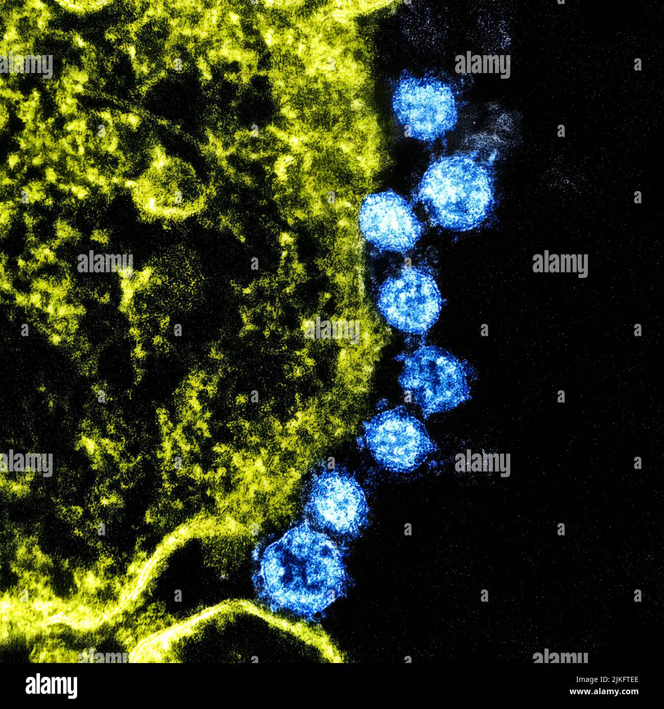 Kolorierte Transmissionselektronenmikrographie MERS-Viruspartikel (blau) in der Nähe der Peripherie einer infizierten VERO E6-Zelle (gelb). Stockfoto